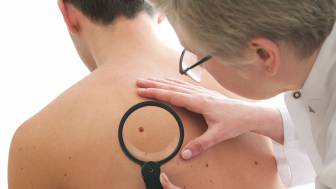 Hautkrebsvorsorge: Vorbeugung und Früherkennung