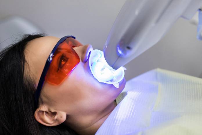 Bleaching der Zähne mit UV-Lampe